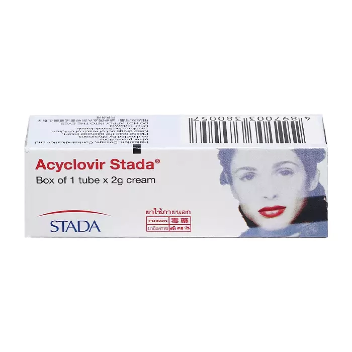 Acyclovir Stada 2g - Kem trị virus Herpes Simplex